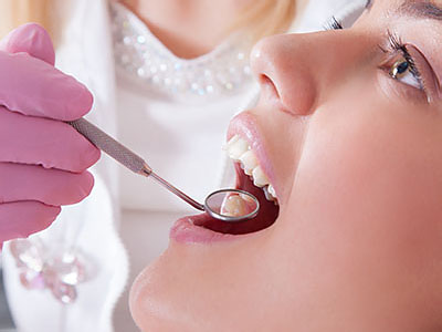 Dental Excellence | Extractions, Teeth Whitening and Implant Dentistry